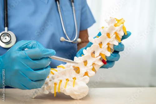 Cuadro en lienzo Doctor holding lumbar vertebrae spine skeleton bone and spinal nerve with displaced herniated disc fragment for treatment medical in the orthopedic department
