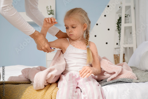 Little girl ill with chicke...