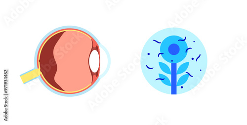 Myodesopsia eye floaters