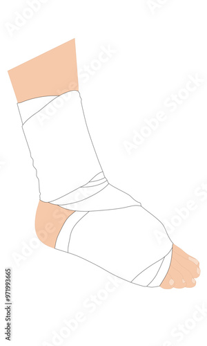 Foot and ankle injury with white elastic bandage for treatment. Flat Vector. Vector Medical Illustration.