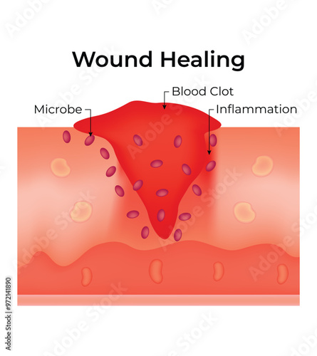 Wound Healing Science Design Vector Illustration Diagram