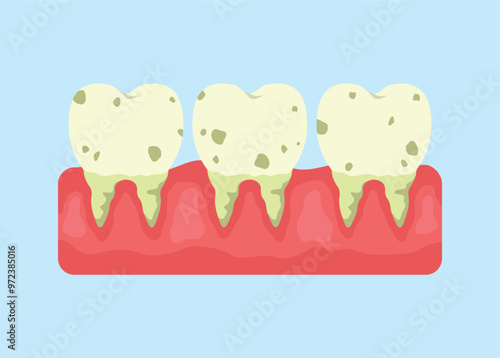 concept illustration of yellow teeth, dirty teeth, flat style vector illustration.
