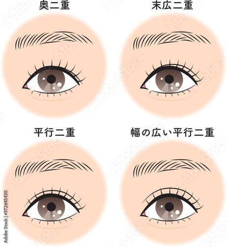二重の種類セット