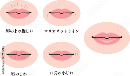 口元のシワのセット