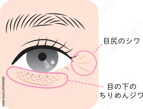 目の周りのシワ