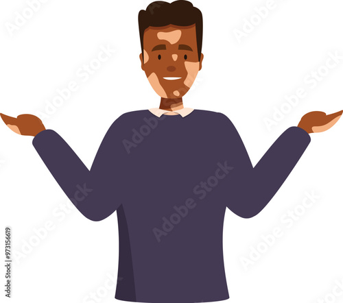 Friendly man is spreading his hands, showing his vitiligo, a condition in which the skin loses its pigment