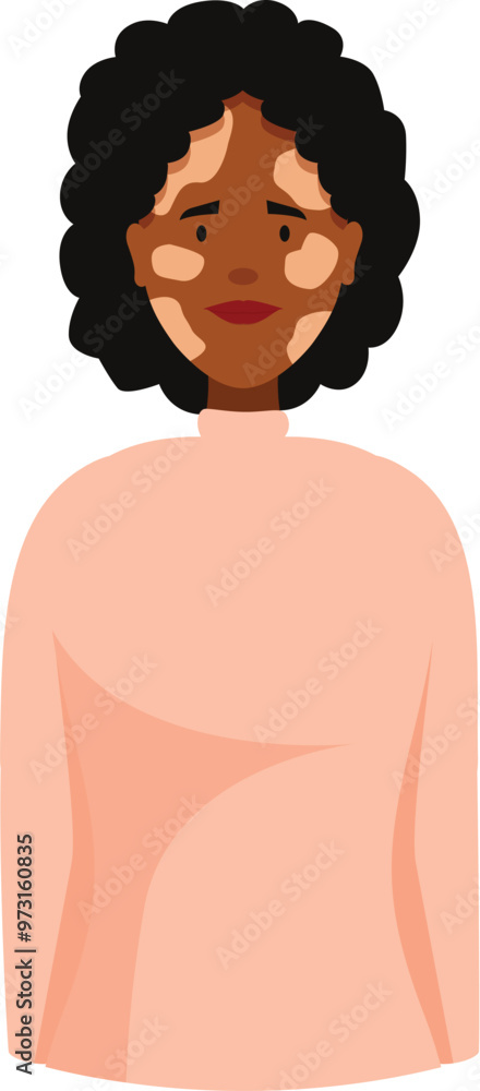 Young black woman with vitiligo smiling and posing for a portrait, celebrating diversity and self acceptance Young black woman with vitiligo smiling and posing for a portrait, celebrating diversity and self acceptance