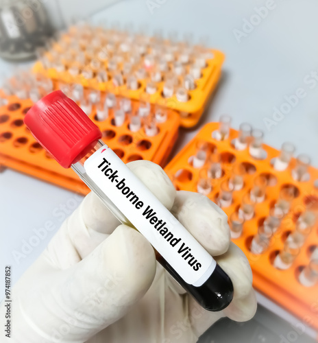 Blood sample for Tick-borne Wetland virus test. photo