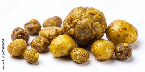 Macro view of yellowish-brown gallstones passage in human feces, illustrating gastrointestinal health issue, with photo