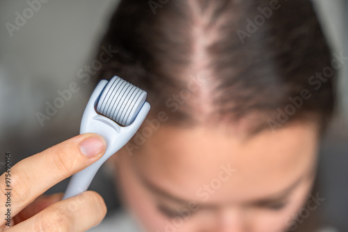 Tableau sur toile Close up view of young woman using microneedle derma roller on head for stimulating new hair growth in home