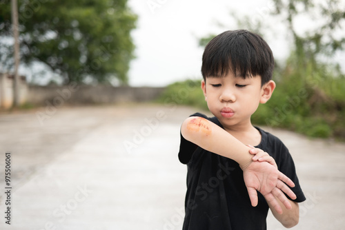 Thai boy examining a fresh scrape on his elbow, standing outdoors and blowing on the wound. photo