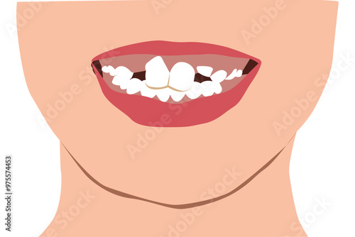 buck teeth clipart or illustration isolated on a transparent background