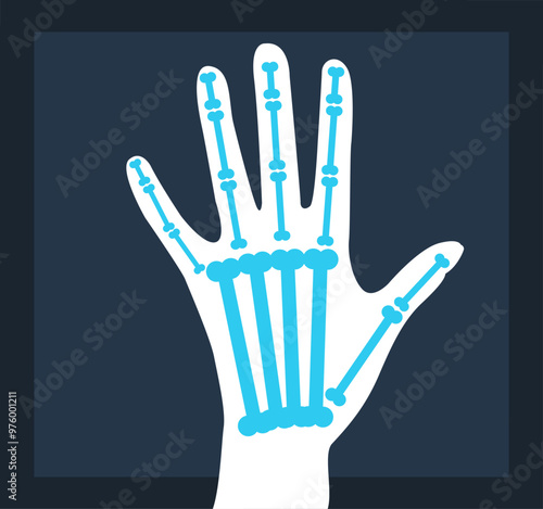 Hand arm x ray radiography medicine concept. Vector flat graphic design cartoon illustration