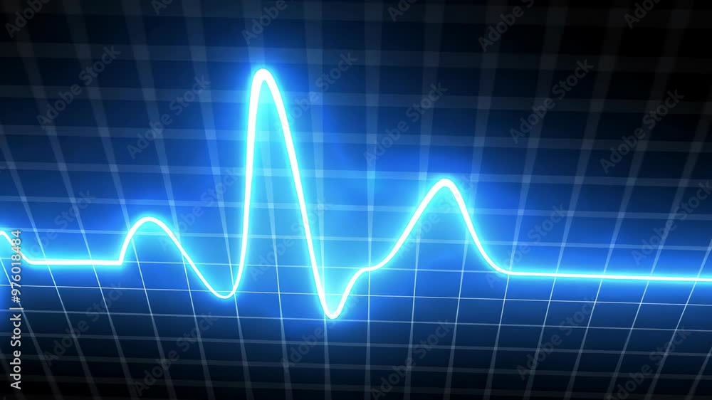 A vibrant blue heartbeat waveform contrasts against a dark grid, symbolizing vital signs and sound. Ideal for healthcare and tech projects, it embodies life and monitoring themes. A vibrant blue heartbeat waveform contrasts against a dark grid, symbolizing vital signs and sound. Ideal for healthcare and tech projects, it embodies life and monitoring themes.