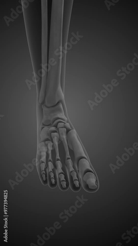 Chronic feet pain syndrome animation
