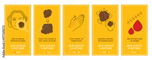 Skin cancer, malignant melanoma symptoms. Vertical banners with outline icons.