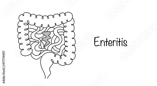 Billede på lærred Enteritis