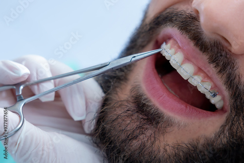 Medical professional oral checkup with dental equipment to examine the patient's mouth