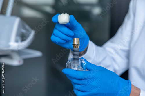 Unrecognizable doctor holding dental layout of upper veneers of teeth prothesis