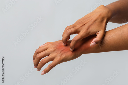 Wallpaper Mural Cropped of afro woman scratching her hand, suffering from psoriasis, grey background Torontodigital.ca