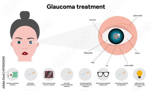 Glaucoma treatment medical information and anatomy ophthalmologist