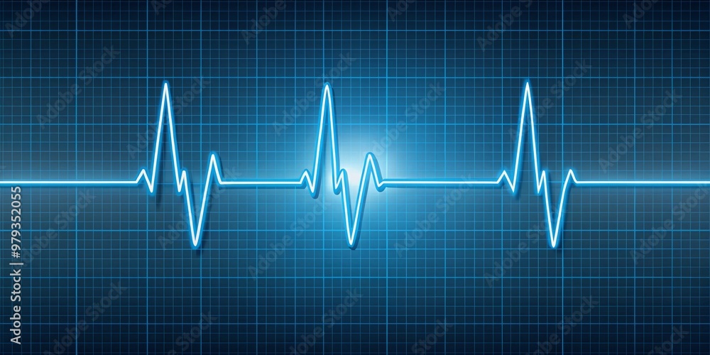 Medical heartbeat graph on a gradient blue backdrop, depicting a precise representation of ECG sinus tachycardia with a heart rate of 120 beats per minute Medical heartbeat graph on a gradient blue backdrop, depicting a precise representation of ECG sinus tachycardia with a heart rate of 120 beats per minute