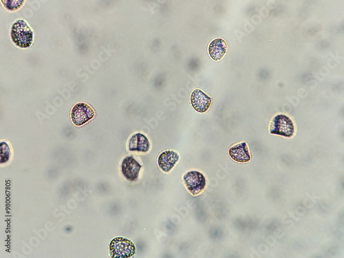 Photography photo of archegonia spores under the microscope