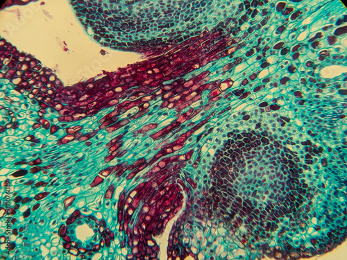 photo of archegonium tissue under the microscope photo