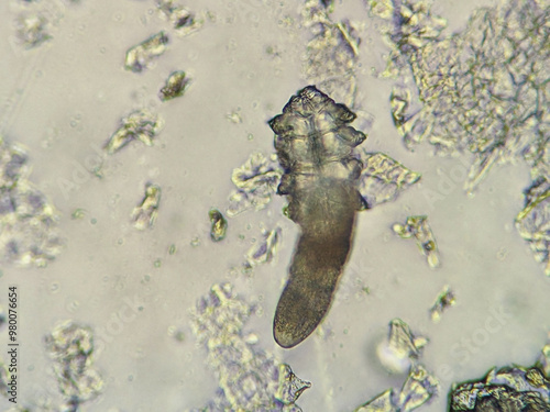 photo of demodex face mite under the microscope photo