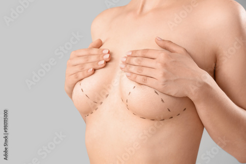 Young woman with marks on h...