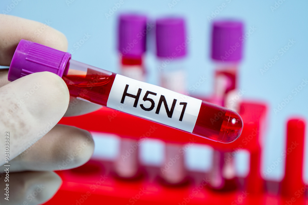 Obraz premium Blood collection tubes H5N1 bird flu test positive results,Medical health concept