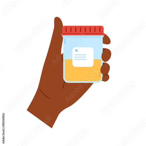 African hand holds container with urine sample. Plastic containers with biomaterial. Urine analysis