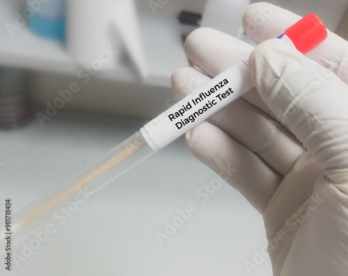 Swab Sample for H1N1Flu (swine flu) test. Influenza virus. Rapid Influenza Antigen. photo