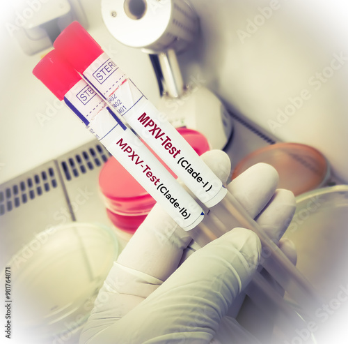 Swab sample for monkey pox virus (MPXV) test. Mpox (formerly known as monkeypox) is a disease caused by infection with a virus, known as Monkeypox virus. zoonotic disease. photo