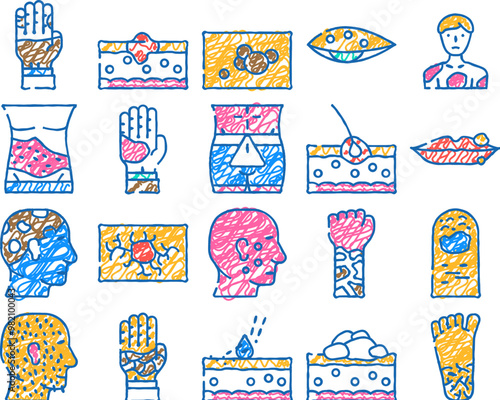 skin disease human health problem doodle icons set vector. sketch line art phytophotodermatitis and psoriasis, atopic dermatitis and angioma, hypertrichosis and angiokeratoma skin color illustrations