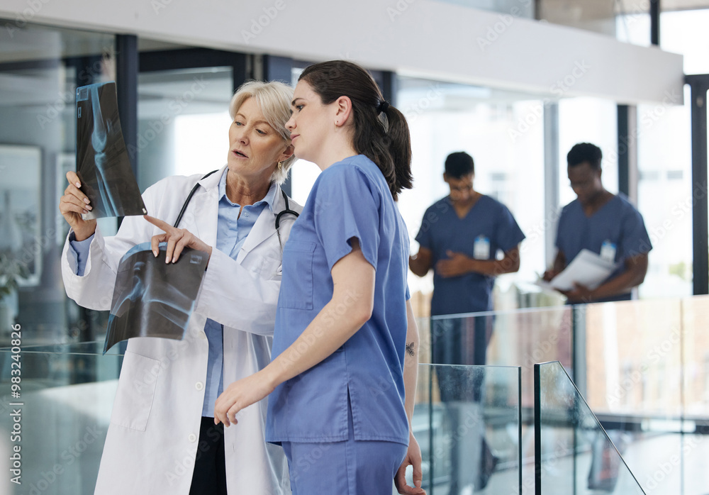 Xray, discussion and doctor with nurse in hospital planning surgery for medical diagnosis. Conversation, surgeon and team of healthcare professionals with body radiology scan for operation in clinic. Xray, discussion and doctor with nurse in hospital planning surgery for medical diagnosis. Conversation, surgeon and team of healthcare professionals with body radiology scan for operation in clinic.