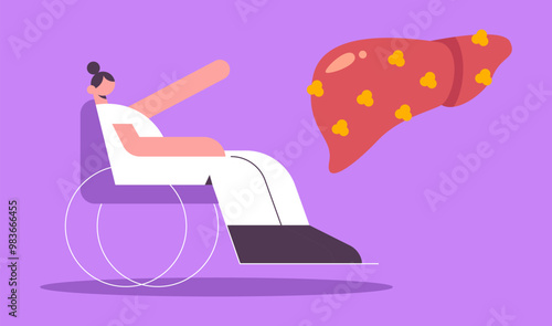 Women point on Liver full of fat. Fatty disease of the liver organ or Hepatosteatosis. Increased fat deposition in the liver. warning about problematic organs. Flat vector illustration.