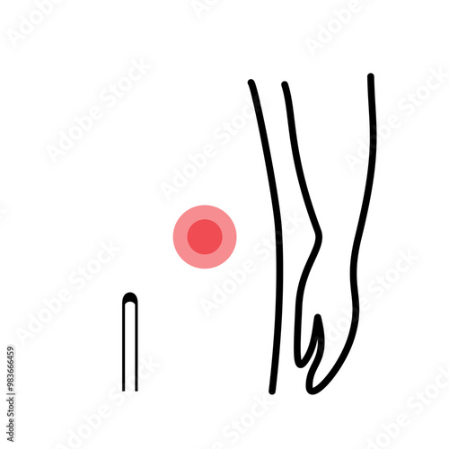 Body pain point injury