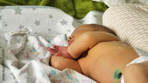 A sleeping newborn baby lying in a crouched position, wearing only a nappy. Smooth yellowish skin of the baby. There is an umbilical wound on the abdomen, which has been treated with antiseptic photo