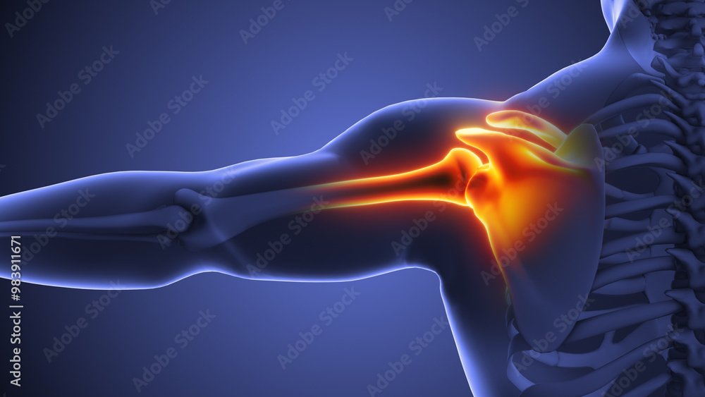 Animation depicting human shoulder discomfort Animation depicting human shoulder discomfort
