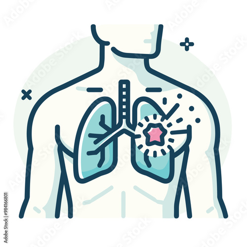 Human anatomy of lungs with highlighted tumor  medical illustration