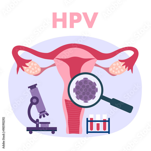 HPV (Human Papillomavirus) Cervical cancer screening and treatment, PAP test, viruses some strains infect genitals and can cause cervical cancer. women health concept.