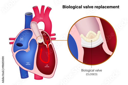 Aortic valve replacement with biological valve. Close up of closed biological valve. Heart anatomy vector. 