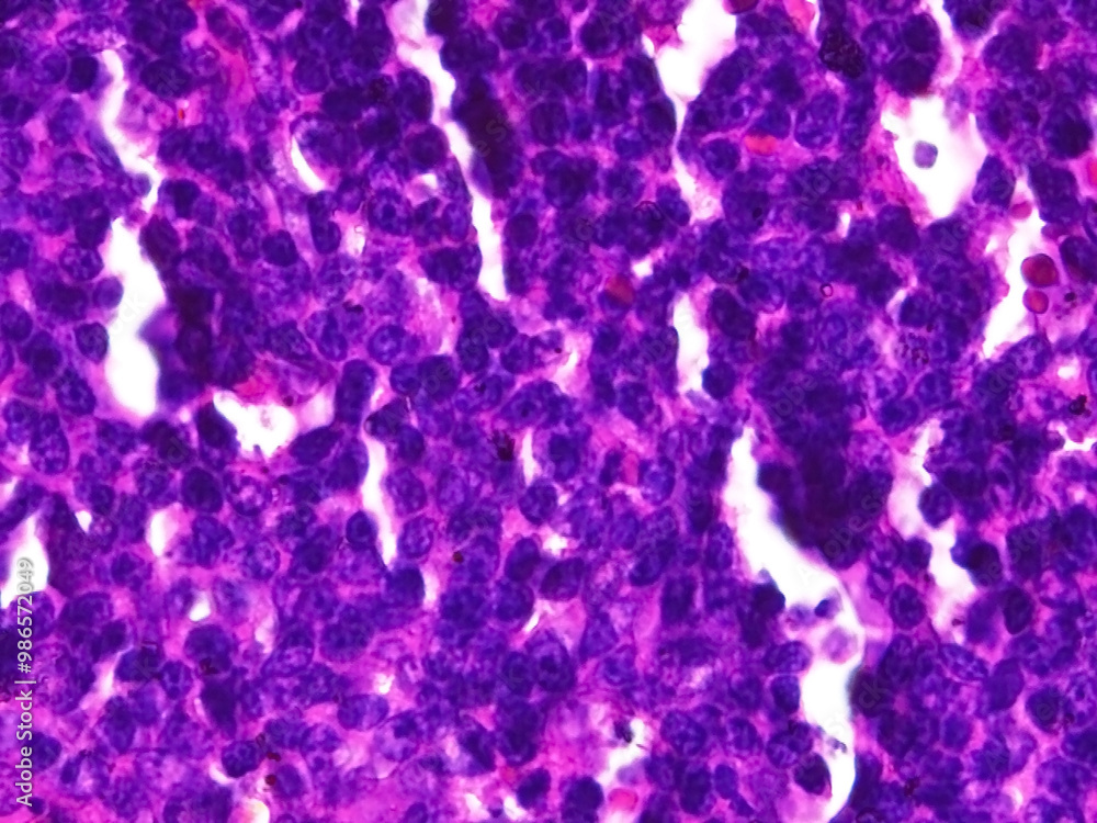 white pulp Histopathology in Rat Spleen: Microscopic Features at 400x Magnificationbackground with bubbles white pulp Histopathology in Rat Spleen: Microscopic Features at 400x Magnificationbackground with bubbles