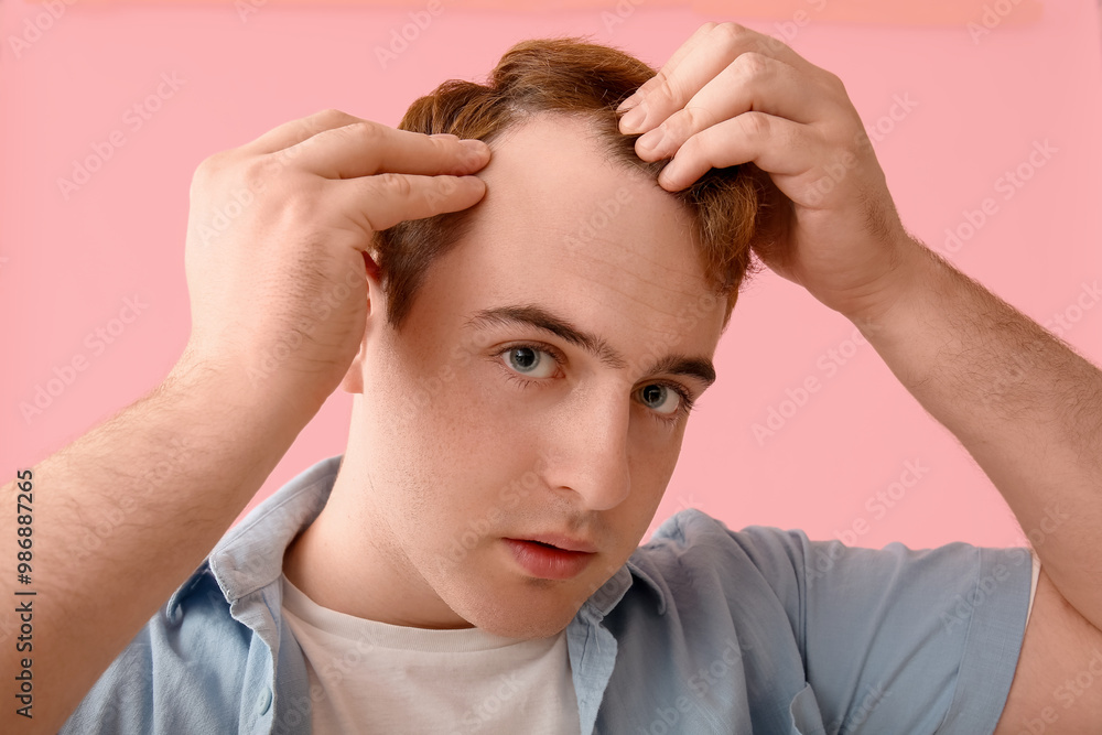 Young redhead man with hair loss problem on pink background Young redhead man with hair loss problem on pink background