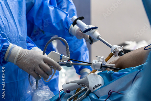 Papier peint gastric sleeve surgery performing by surgeon