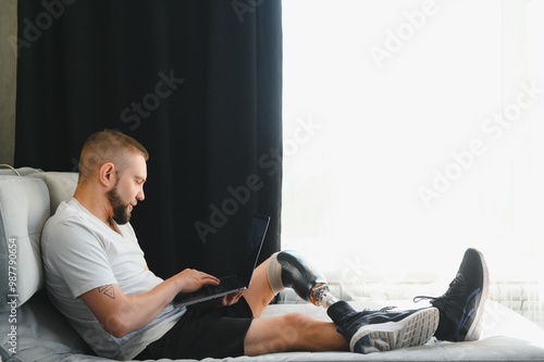 Man amputee with prosthetic leg disability on above knee transfemoral leg prosthesis artificial device, close up. People with amputation disabilities everyday life photo