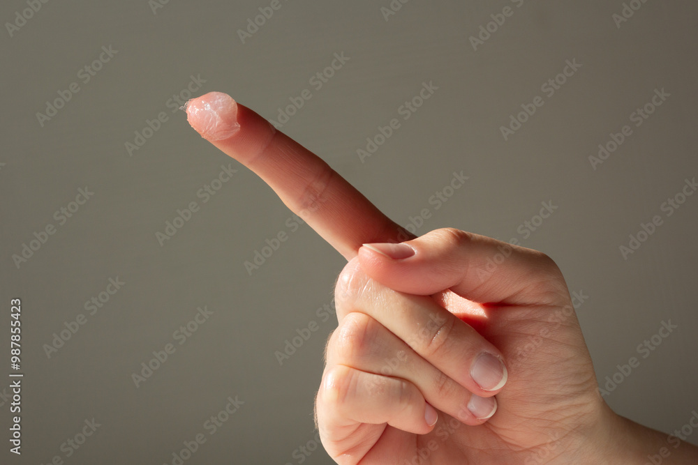 Closeup of a person applying petroleum jelly to their hand.