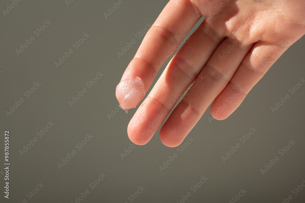 Closeup of a person applying petroleum jelly to their hand.