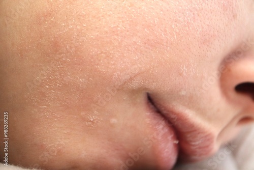 乾燥肌の女性の顔の皮膚のクローズアップ